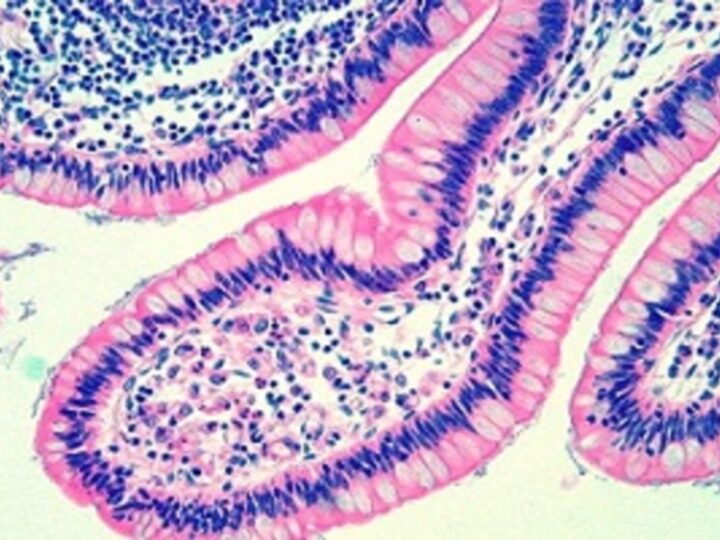 Hematoxylin and Eosin staining of Tissue Section
